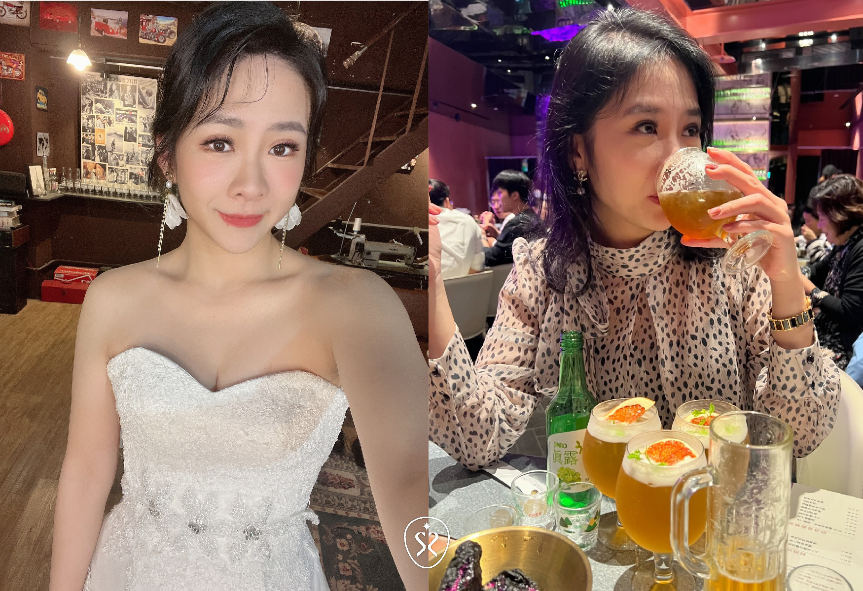 【喬雅登玻尿酸】